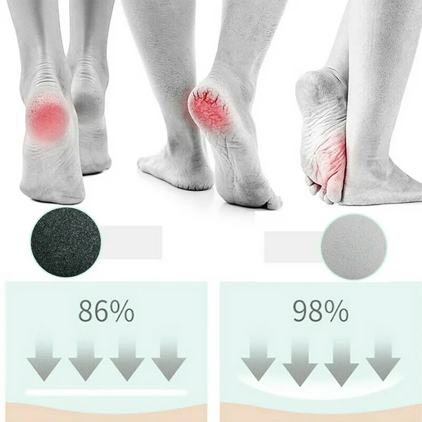 RECHARGEABLE FOOT CALLUS REMOVER - Image 3